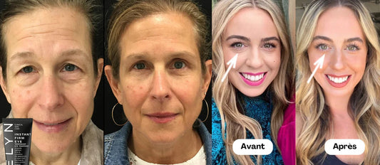 Instant Lift Plus Harvey avis : test utilisateur complet (7 jours) + comparatif