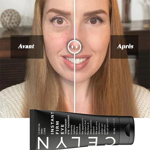 Crème Anti‑Cernes et Rides Licyana : Mon avis honnête après 7 jours