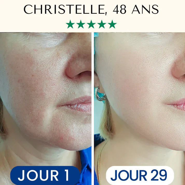 Fontanay Skin Avis : Mon Test Complet et Retour d’Expérience sur le LightPro 7en1