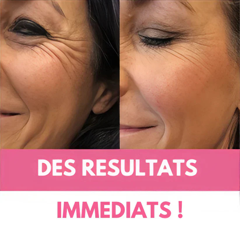 Lumeor : Avis, résultats et guide complet sur le masque Collagène