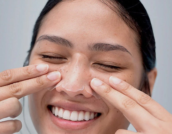 Vue Swiss avis : test des patchs hydrocolloïdes pour le nez