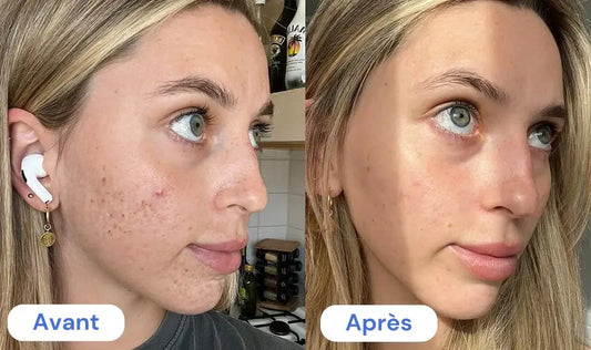 Nura Cosmetic avis : Le masque au bio-collagène tient-il ses promesses ? (test & guide complet)