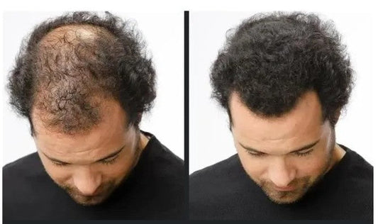 Elbora Shampoing Spartan Avis : Test Complet & Résultats Réels