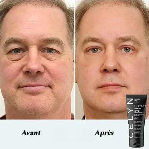 Vaniqui Avis : Tout Ce Qu’il Faut Savoir Sur Cette Crème Anti-Âge Innovante