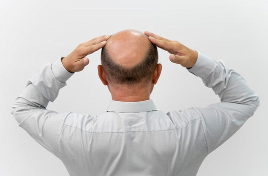 alphaderma avis : arnaque marketing ou vraie aide contre la chute des cheveux ?