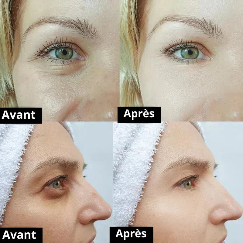 RoveaSkin Avis 2026 – Mon test complet de la crème anti-cernes (et de toute la gamme) après 30 jours d’utilisation