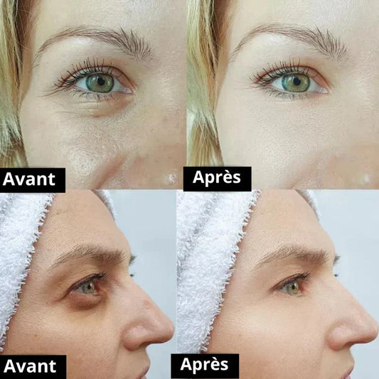 RoveaSkin Avis 2026 – Mon test complet de la crème anti-cernes (et de toute la gamme) après 30 jours d’utilisation