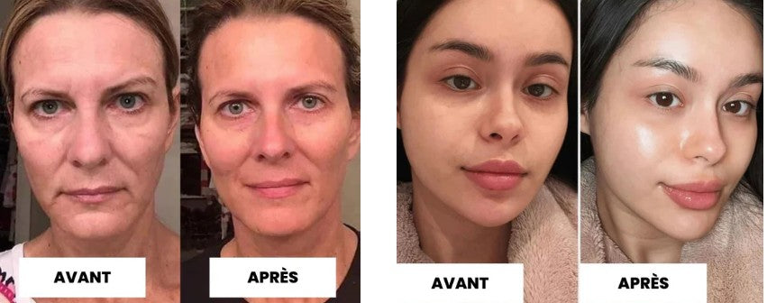 Belury Masque Avis : test complet, résultats réels et comparatif (après 4 semaines)