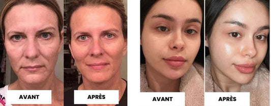 Belury Masque Avis : test complet, résultats réels et comparatif (après 4 semaines)
