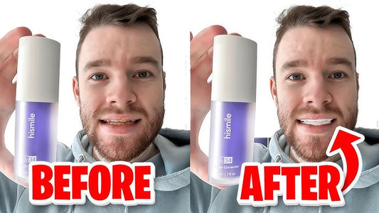 Dentica Avis : Test terrain du Sérum Correcteur SmileKit v34