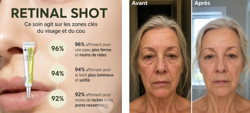 Dermaelia avis : Retinal Shot mérite-t-il vraiment son succès ?