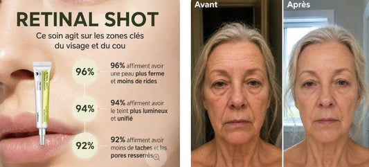 Dermaelia avis : Retinal Shot mérite-t-il vraiment son succès ?