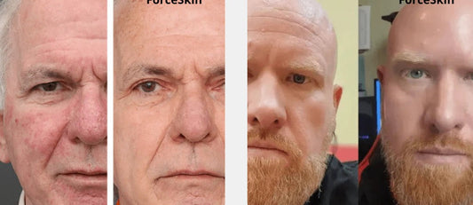 Forceskin avis : test du baume anti-âge, ingrédients passés au crible et comparatif avant d’acheter