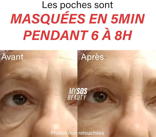 My SOS Beauty Gel Liftant Avis : Tout ce qu’il faut savoir pour un regard instantanément rajeuni