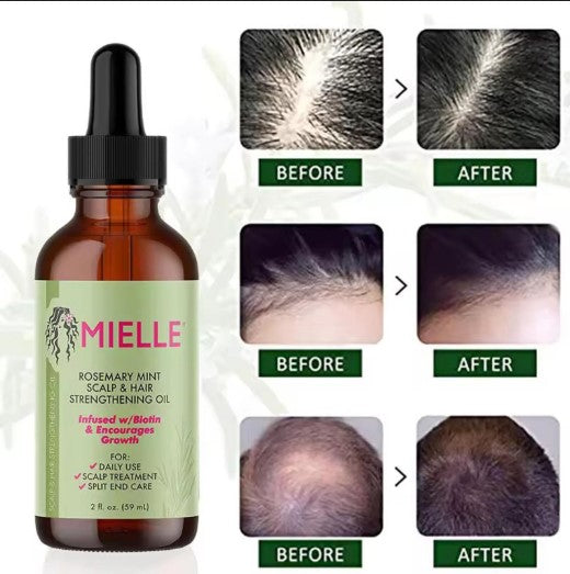 Mielle Rosemary Oil avant après : Une huile capillaire révolutionnaire pour des cheveux sains et forts