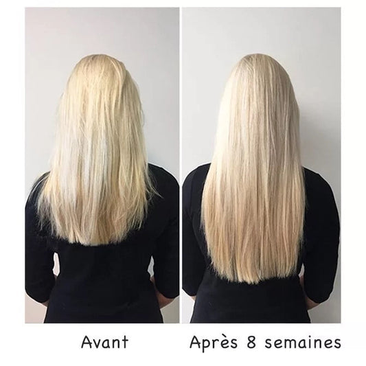 Levona Spray Intense Repousse Avis : mon test complet après 7 jours