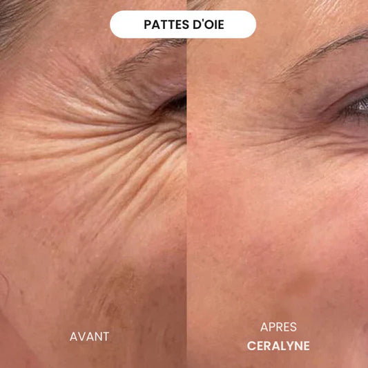 Mercierhair Crème Visage : Avis et test utilisateur complet et résultats avant/après