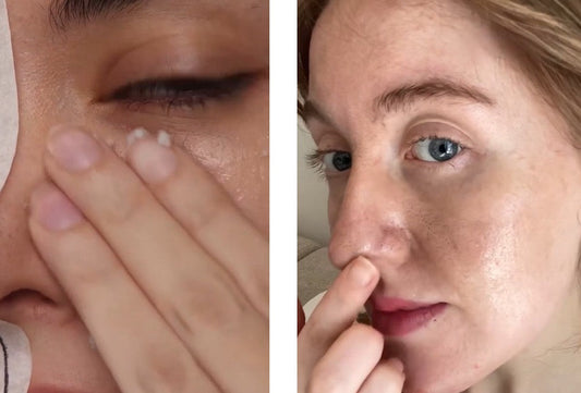 GlowRiz avis : le duo riz blanc & riz noir à la niacinamide vaut-il vraiment le coup ?