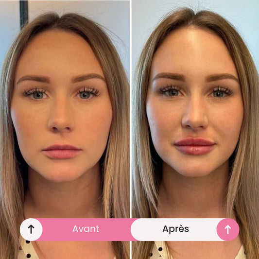 PlumpX : Avis, test et guide d’utilisation du gloss repulpant tendance