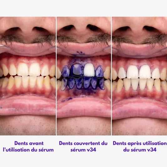 WeSmile Avis : mon test complet du sérum blanchissant V34