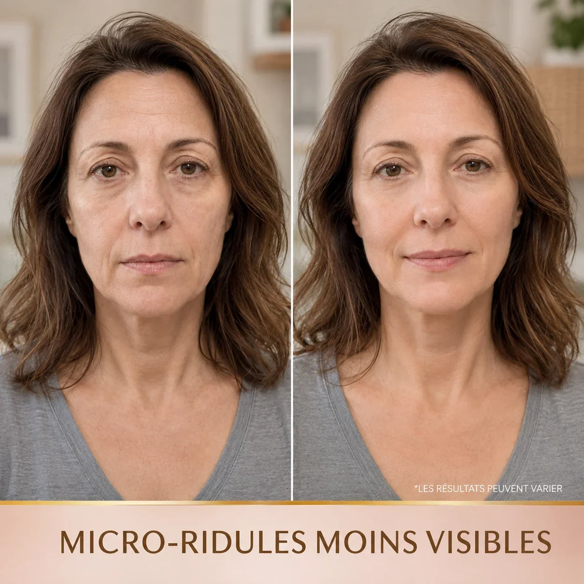 Avant / après sérum coréen aux peptides de soie : ridules moins visibles