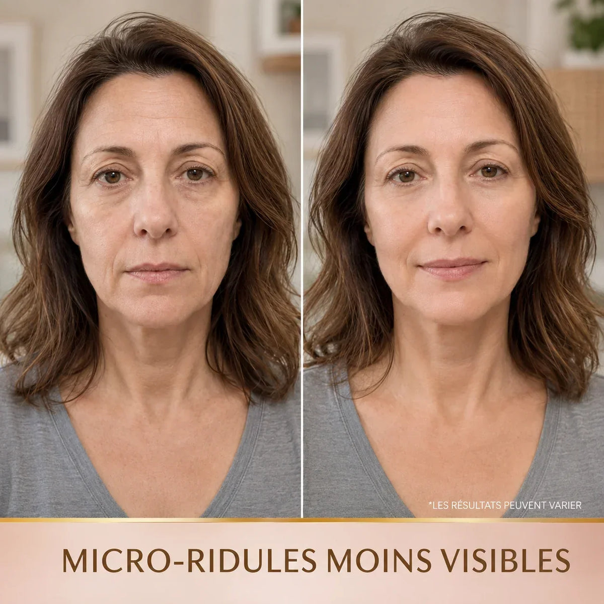 Avant / après sérum coréen aux peptides de soie : ridules moins visibles